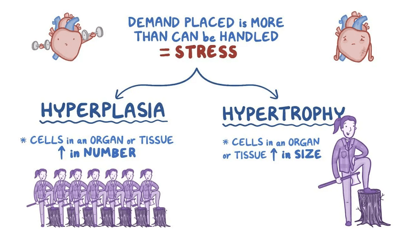 Difference Between Hypertrophy and Hyperplasia