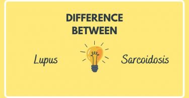 Difference Between Lupus and Sarcoidosis